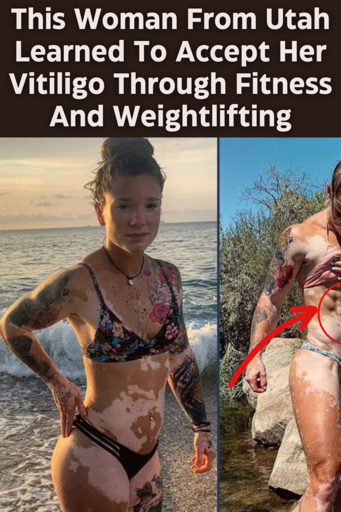 This Woman From Utah Learned To Accept Her Vitiligo Through Fitness And Weightlifting