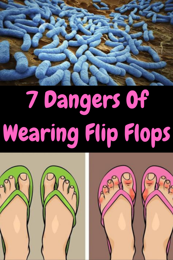 7 Dangers Of Wearing Flip Flops