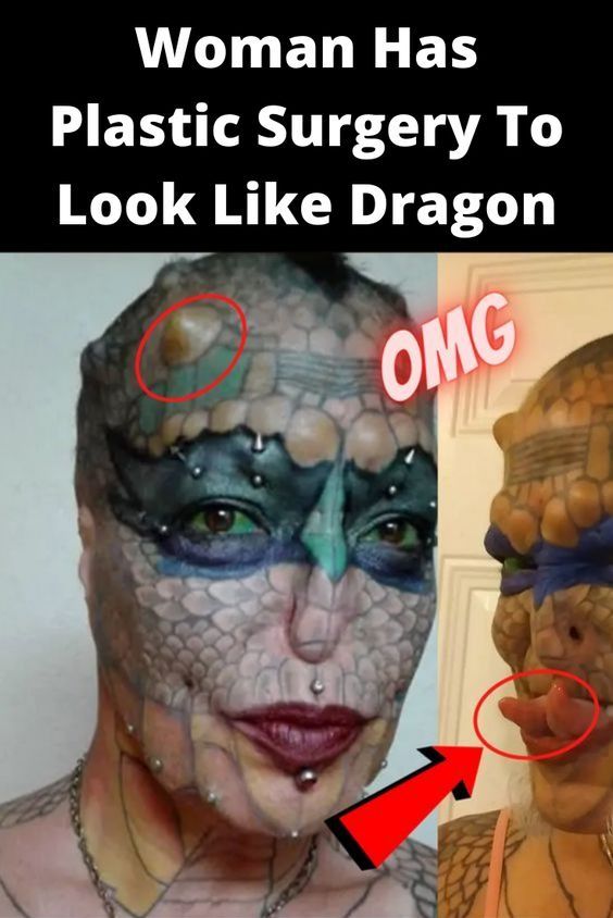 Woman Has Plastic Surgery To Look Like Dragon